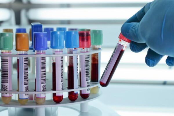 Crucial Blood Tests: Unveiling Health Insights for Disease Detection